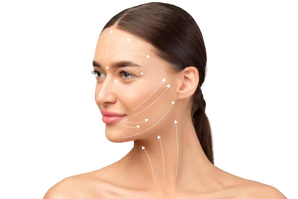 Thread Lift Treatment