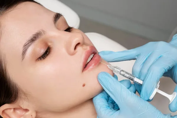 Lip Augmentation