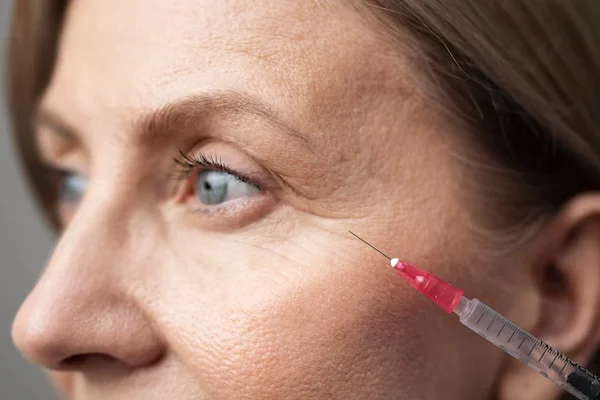 Wrinkle Treatment